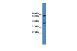 BBS5 Antibody, Novus Biologicals 100 &mu;L | Buy Online | Novus Biologicals | Fisher Scientific